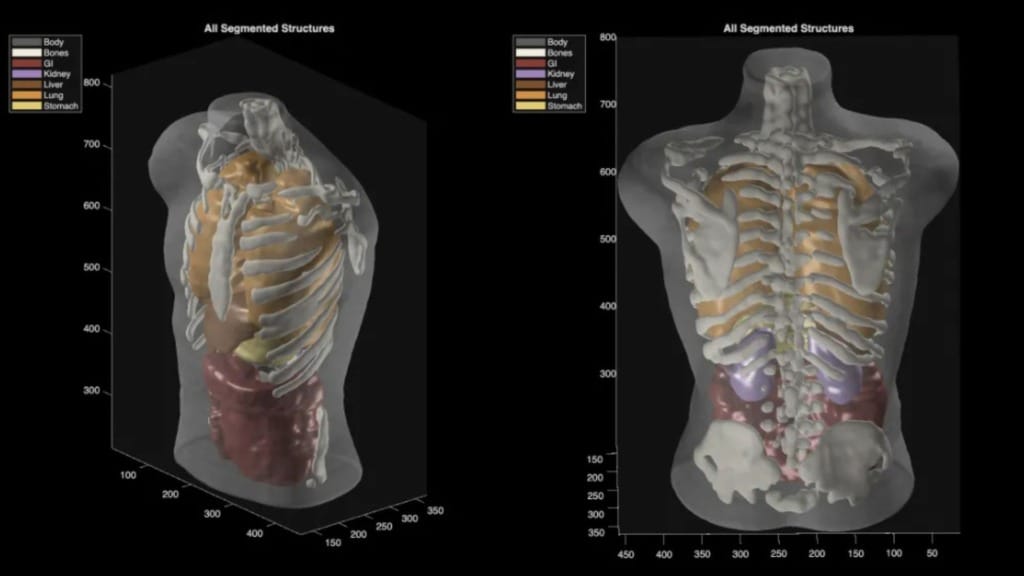 Midjourney unveils full-body ultrasonic scanner aimed at transforming medical imaging Midjourney unveils full-body ultrasonic scanner aimed at transforming medical imaging
