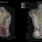 Midjourney unveils full-body ultrasonic scanner aimed at transforming medical imaging Midjourney unveils full-body ultrasonic scanner aimed at transforming medical imaging