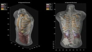 Midjourney unveils full-body ultrasonic scanner aimed at transforming medical imaging Midjourney unveils full-body ultrasonic scanner aimed at transforming medical imaging